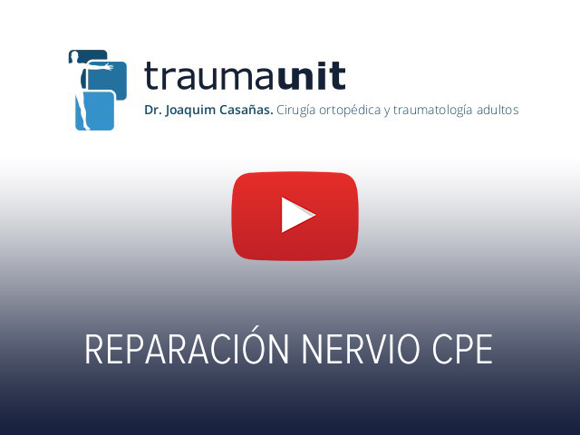 Reparación nervio CPE