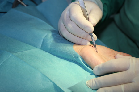 cirugia de la mano y nervio periferico