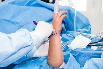 artroscopia cirugia fractura escafoides