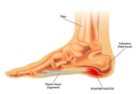 traumaunit patologia pie