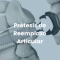 protesis de reemplazo articular