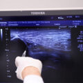 neurorrehabilitacion
