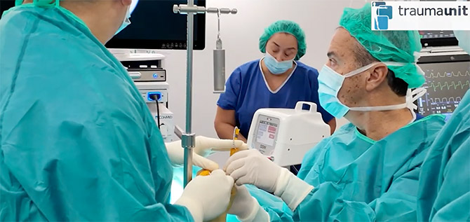 artroscopia de muñeca Traumaunit