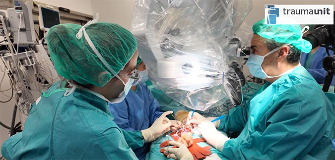 transferencias nerviosas microcirugia