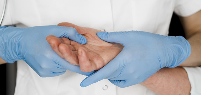 sinovitis tendones de la mano