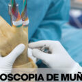 artroscopia de muñeca en Traumaunit