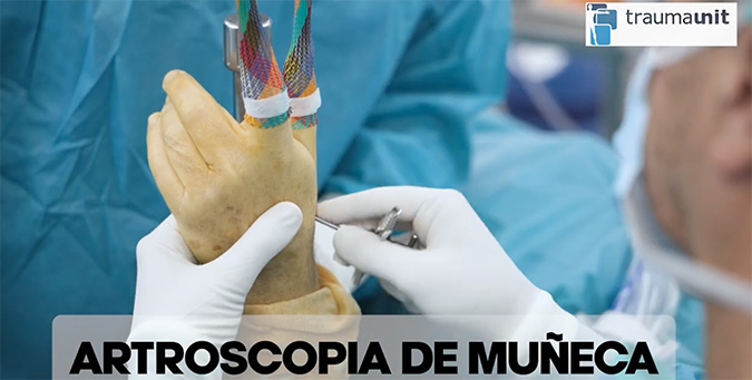 artroscopia de muñeca en Traumaunit